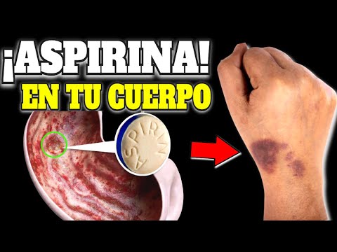 ¿Qué pasa si me tomo 4 aspirinas de 500 mg?