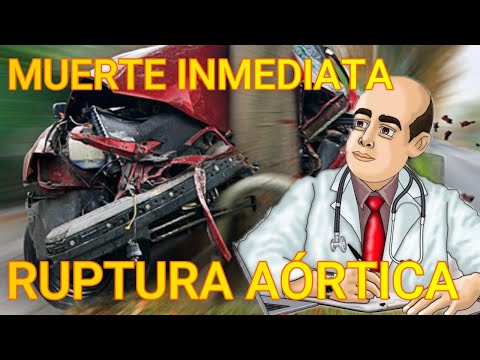 ¿Qué pasa si se rompe la aorta abdominal?