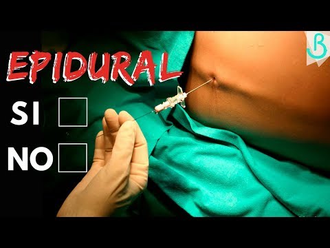 ¿Qué pasa si te ponen mal la epidural?