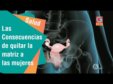 ¿Qué pasa si te quitan el útero? Conoce las consecuencias y cuidados necesarios