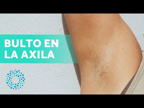 ¿Qué pasa si tienes una bolita en la axila?