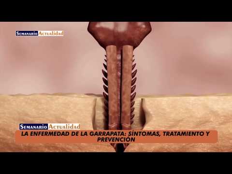 ¿Qué pasa si aplastas una garrapata? Descubre sus consecuencias