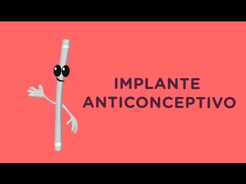 ¿Qué pasa si el implante anticonceptivo se mueve?