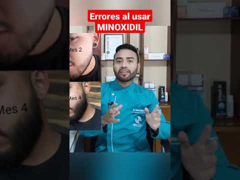 ¿Qué pasa si uso más de 1 ml de minoxidil?