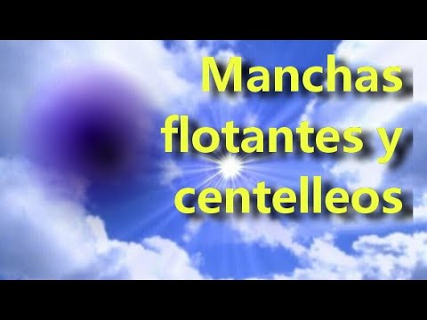 ¿Qué pasa si ves puntos blancos en tu visión?