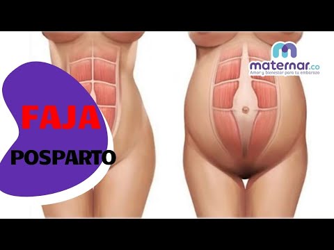 ¿Qué pasa si no uso faja después de una cesárea?