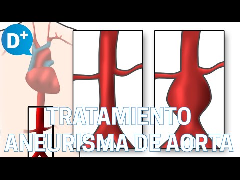 ¿Qué pasa si se corta la arteria aorta? Consecuencias y tratamiento