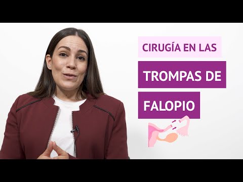 ¿Qué pasa si te quitan una trompa de falopio?