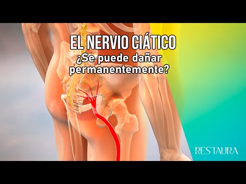 ¿Qué pasa si se inyecta el nervio ciático?