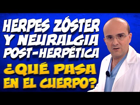 ¿Qué pasa si no se trata el herpes zoster?