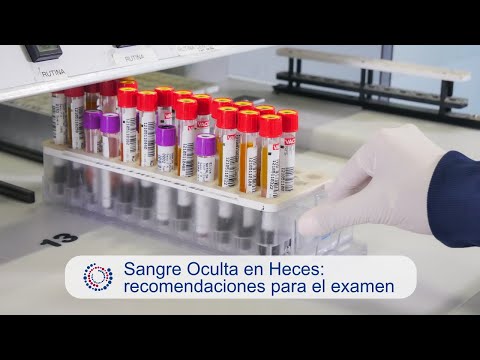 ¿Qué pasa si encuentras sangre oculta en tus heces?