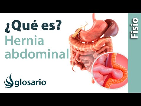 ¿Qué pasa si se revienta una hernia umbilical?