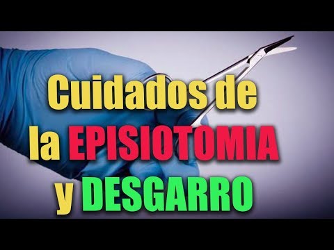 ¿Qué pasa si los puntos de la episiotomía no se caen?