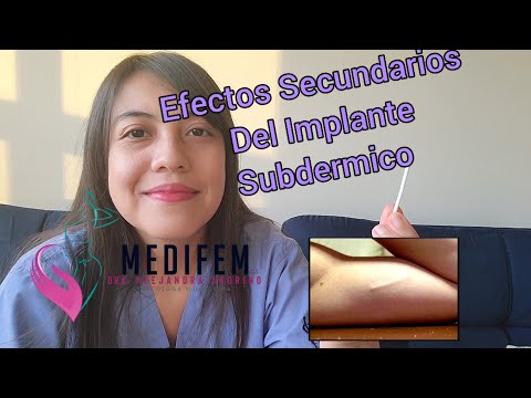 ¿Qué pasa si me pongo el implante y estoy menstruando?