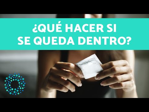 ¿Qué pasa si el condón se queda adentro de la vagina?