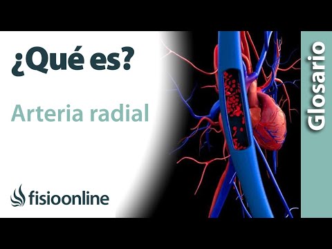 ¿Qué pasa si se corta la arteria radial?