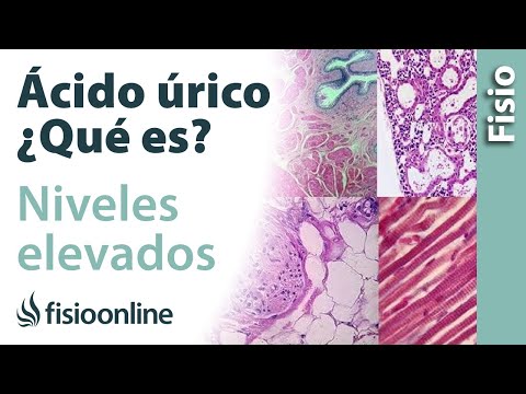 ¿Qué pasa si tengo ácido úrico alto?