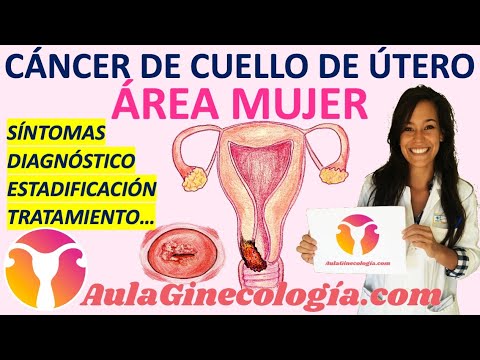 ¿Qué pasa si tengo cáncer de cuello uterino?