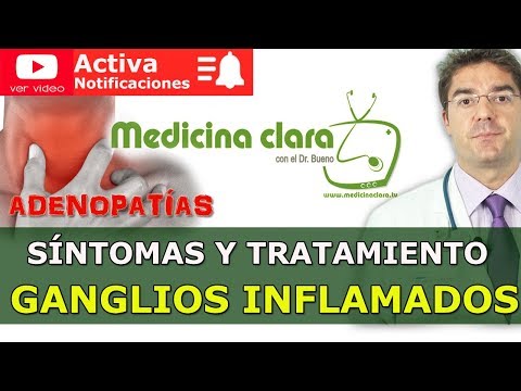 ¿Qué pasa si tienes ganglios inflamados?