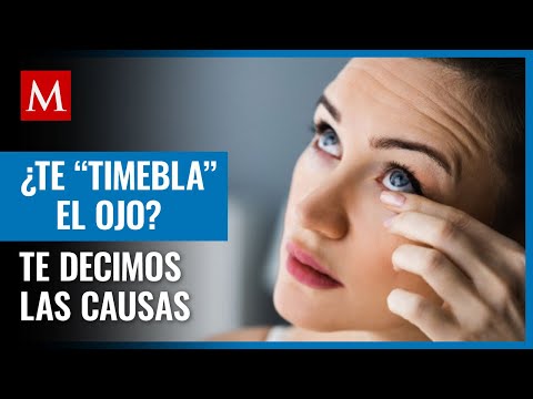 ¿Qué pasa si te tiembla el ojo? Posibles causas y soluciones