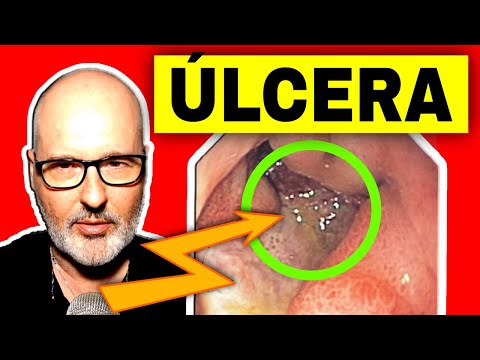 ¿Qué pasa si se revienta una úlcera gástrica?