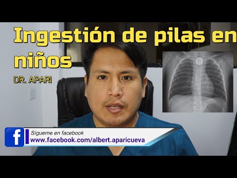 ¿Qué pasa si un niño muerde una pila AAA?