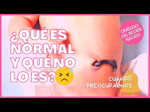 ¿Qué pasa si se cae el ombligo antes de tiempo?