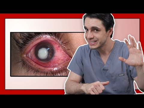 ¿Qué pasa si usas lentillas caducadas?