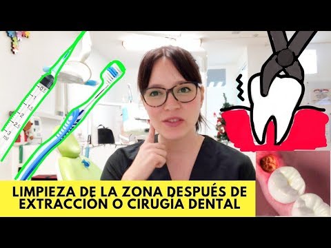 ¿Qué pasa si entra comida en la extracción de muela?