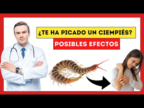 ¿Qué pasa si un ciempiés te pica?