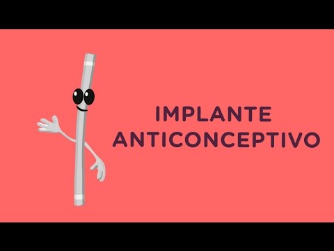 ¿Qué pasa si mi implante anticonceptivo se vence?