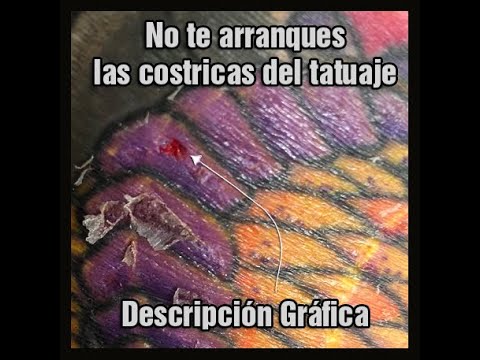 ¿Qué pasa si te quitas la costra de un tatuaje?