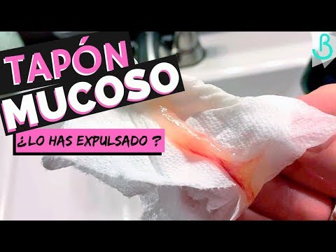 ¿Qué pasa si boto el tapón mucoso durante el embarazo?