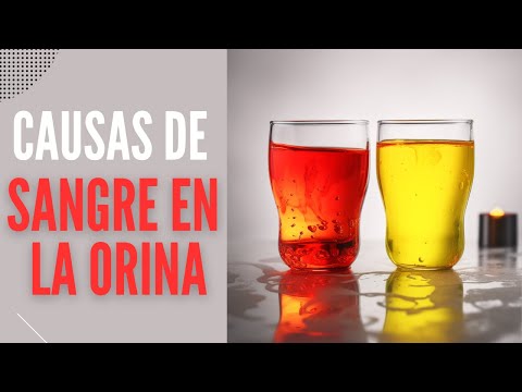 ¿Qué pasa si hay sangre en la orina? Causas y tratamientos posibles