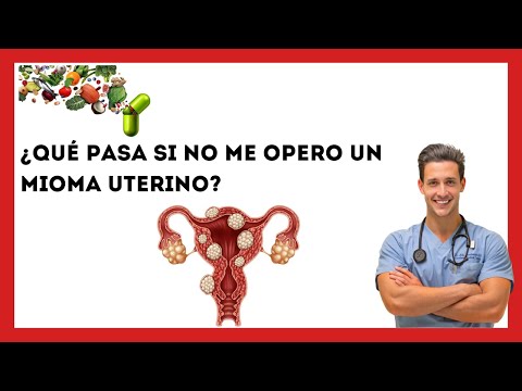 ¿Qué pasa si no me opero un mioma?