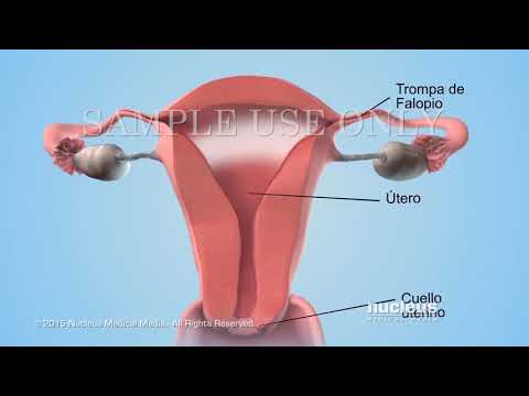 ¿Qué pasa si un espermatozoide anormal fecunda un óvulo?