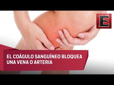 ¿Qué pasa si se revienta una vena? Consecuencias y tratamiento