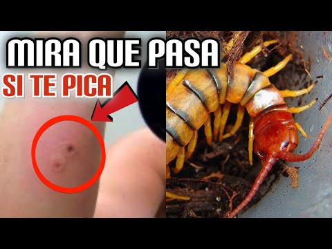 ¿Qué pasa si te pica un ciempiés?