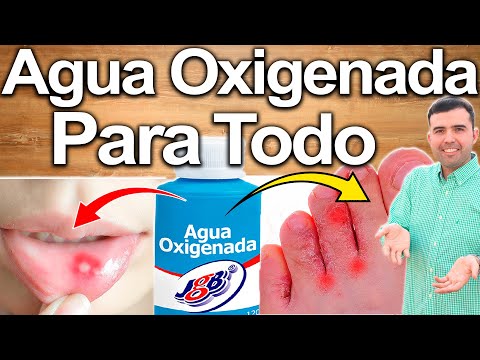 ¿Qué pasa si te echas agua oxigenada en el cabello?