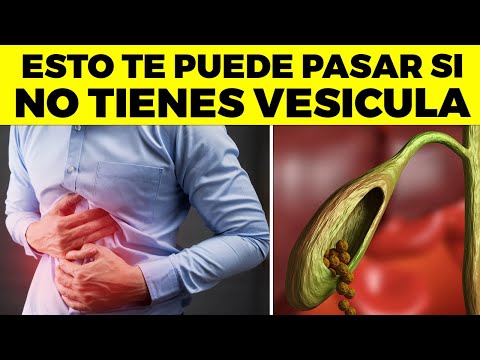 ¿Qué pasa si ya no tienes vesícula?