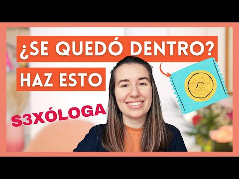 ¿Qué pasa si el condón queda dentro de la mujer?