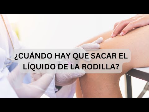 ¿Qué pasa si se riega el líquido de la rodilla?